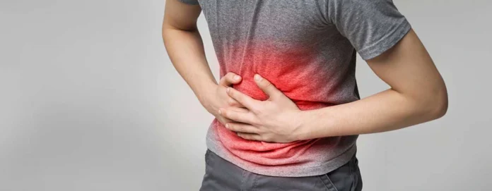4 stages of appendicitis